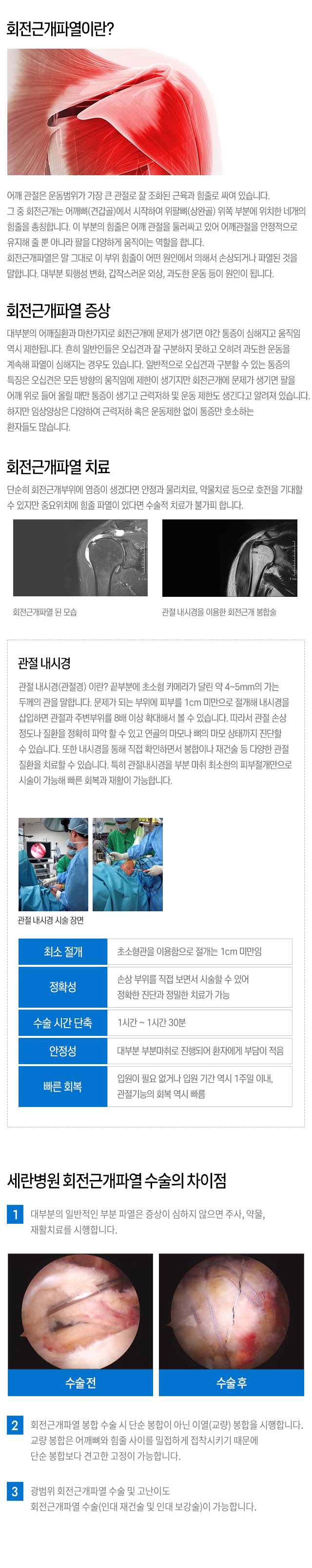 회전근개파열