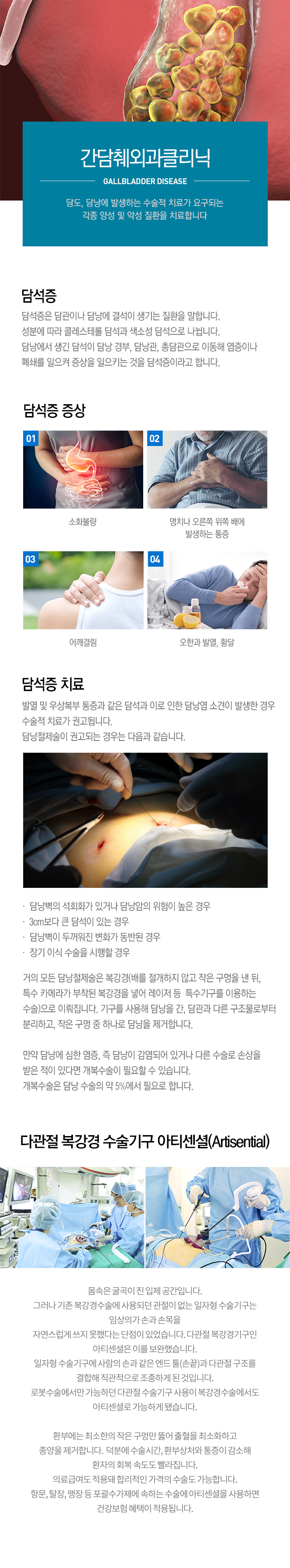 담석증