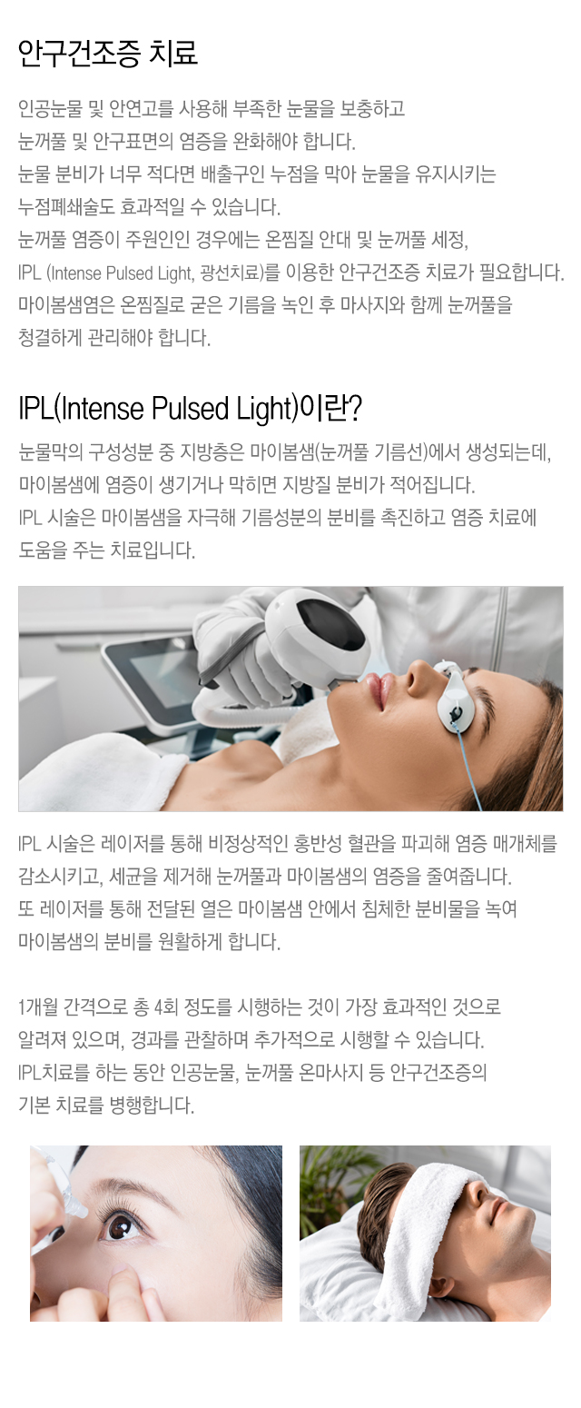 안구건조증 치료